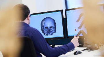 3D-visualisatie na een CT-scan